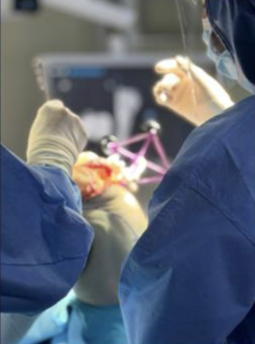 Robotic Joint Replacement in progress for complex knee case